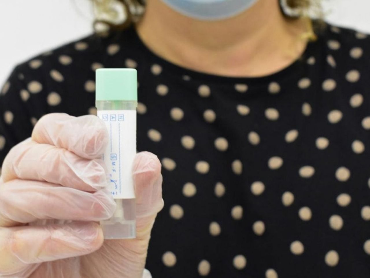 Nuevos avances permiten personalizar cada vez más el tratamiento del cáncer colorrectal
