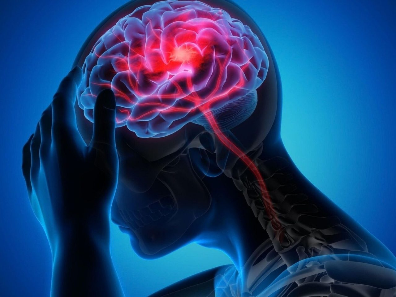 Un medicamento ya conocido podría abrir una nueva vía frente al aura de migraña